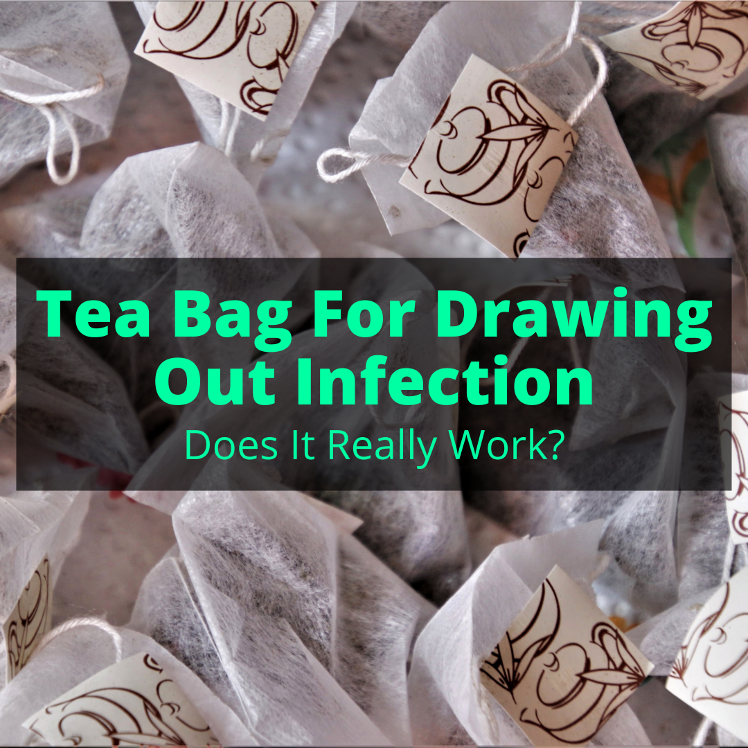 Tea Bag For Drawing Out Infection (Does It Really Work?)