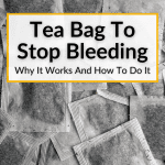 Tea Bag To Stop Bleeding