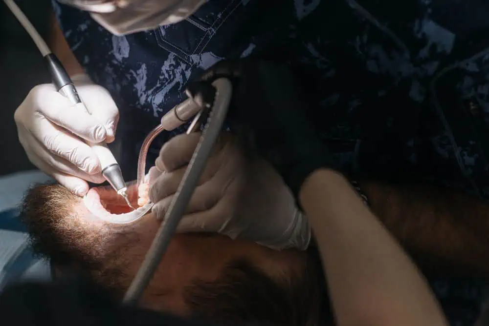 man having wisdom teeth extracted