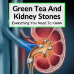 Green Tea Kidney Stones